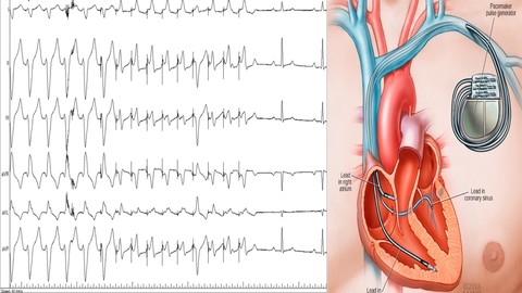 Master Cardiac Device & Rhythm Management Level 1