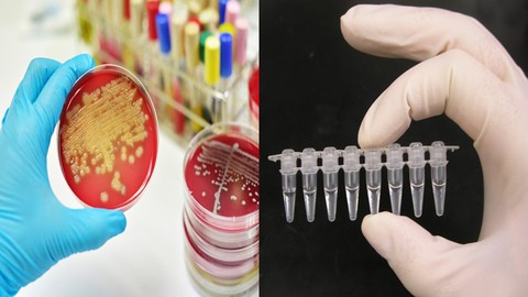 Métodos Convencionais e Moleculares da Microbiologia