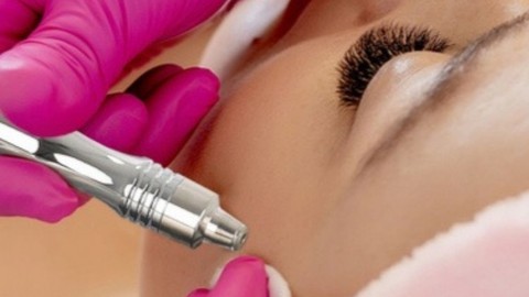 Diamond Microdermabrasion