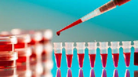 Detailed polymerase chain reaction concepts