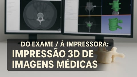 Do Exame à Impressora: Impressão 3D de Imagens Médicas
