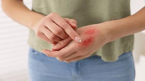 Beyond the Burn: Comprehensive Burn Care Strategies