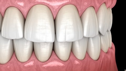 Dental Anatomy Terminology and Abbreviations Made Easy