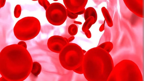 Thalassemia : Definition , Clinical Features & Complications