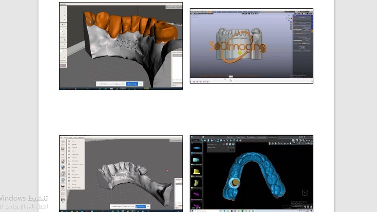 كورس لأطباء الأسنان Dental CAD Design