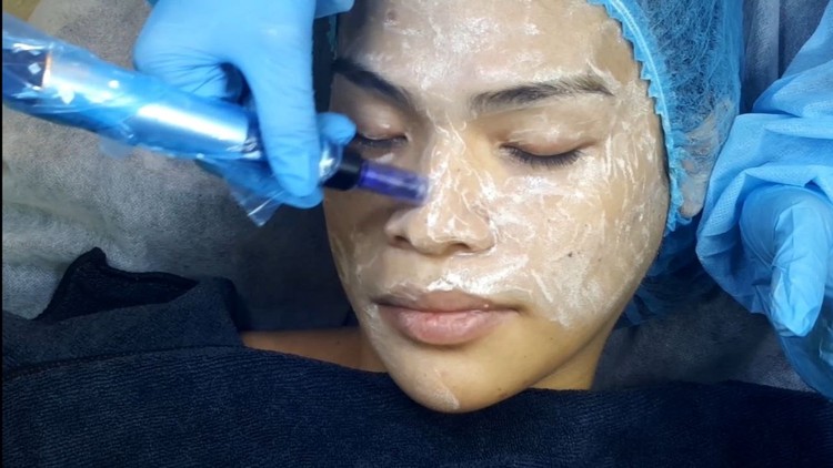 BB Glow Microneedling Training