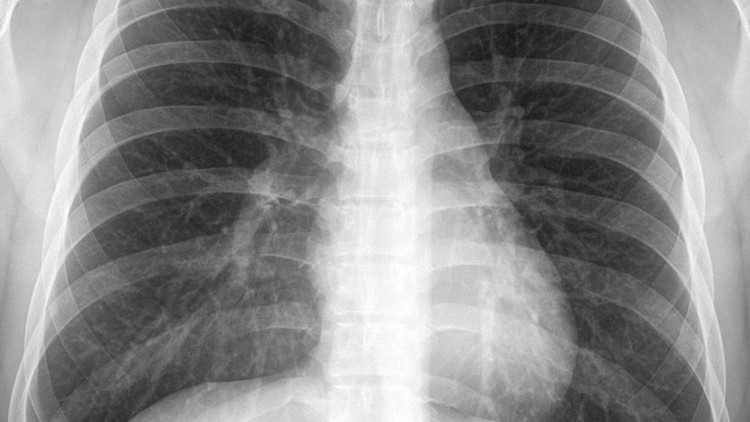 Introduction to X rays and their use in Clinical practice