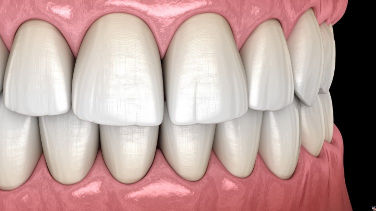 Dental Anatomy Terminology and Abbreviations Made Easy