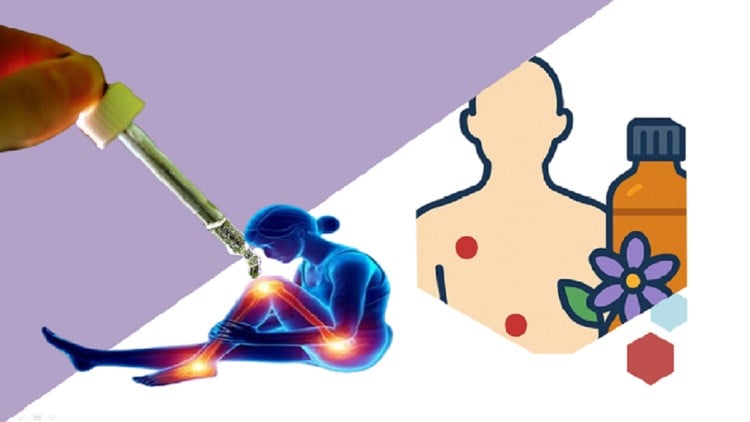 L’Acupression Aromathérapique face aux Douleurs