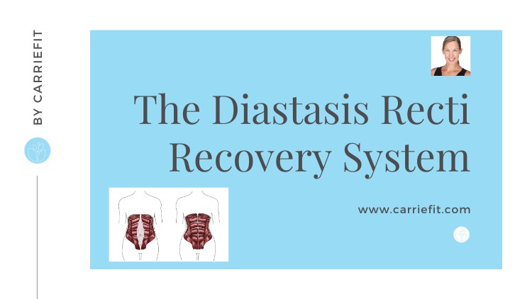 Diastasis Recti Recovery System